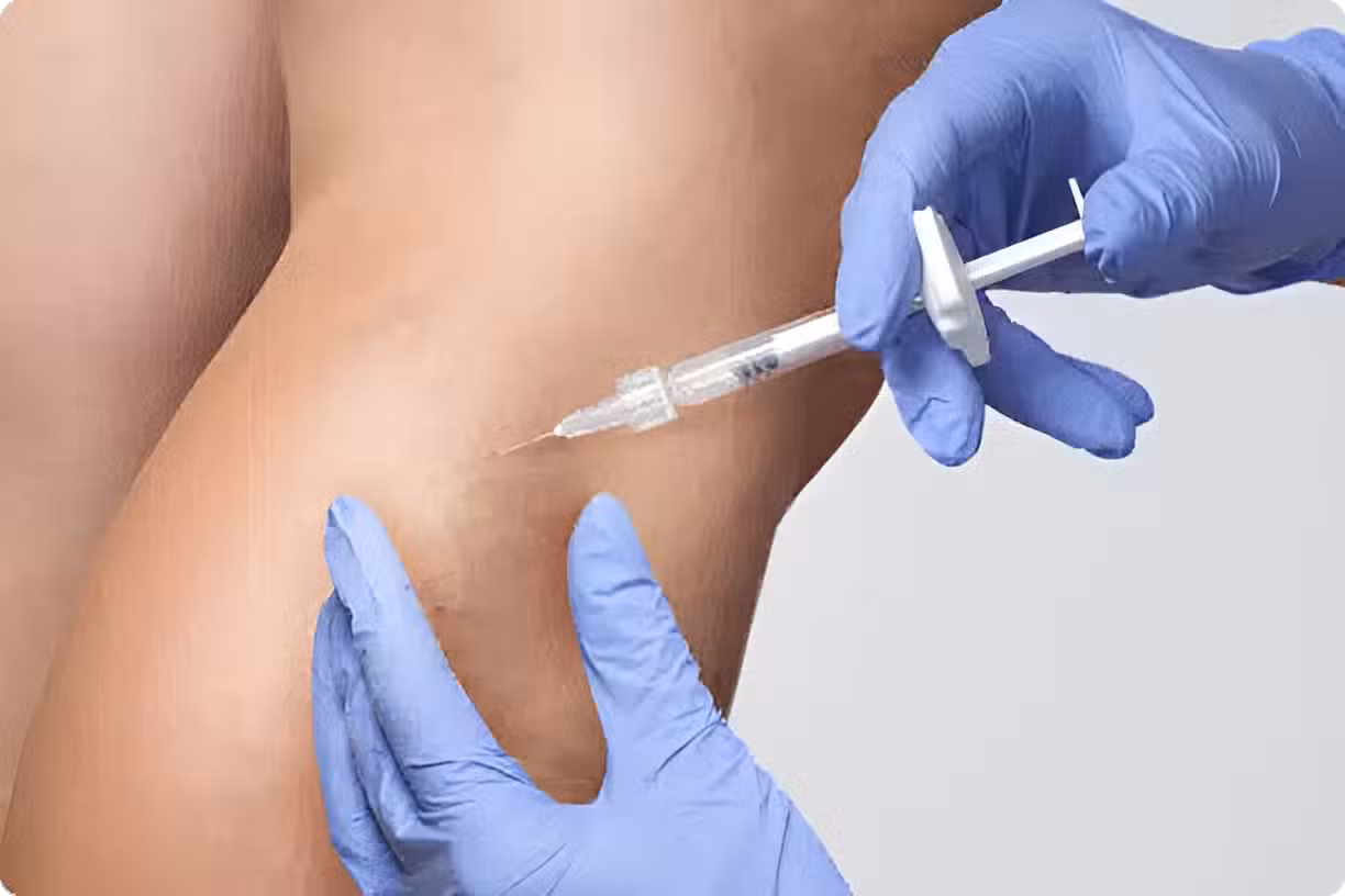 Vein Treatments in Walnut Creek, CA