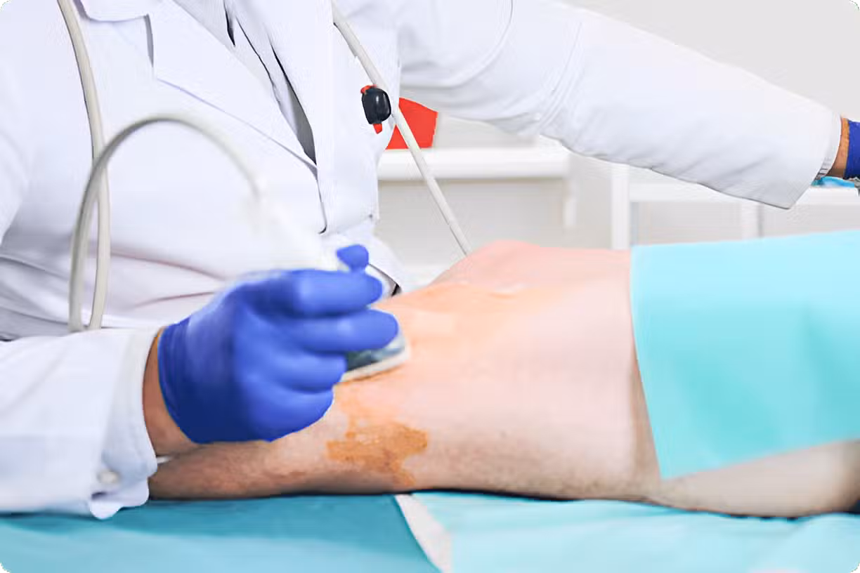 Vein Treatments in Walnut Creek, CA