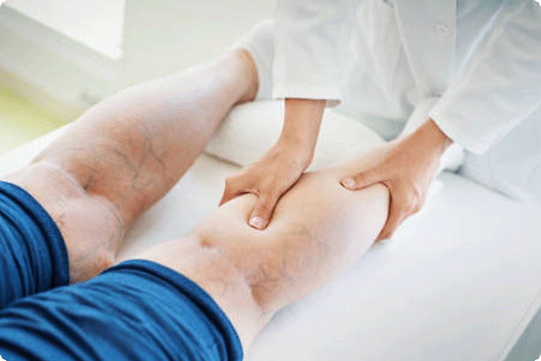 Closeup side view of unrecognizable female doctor massaging legs and calves of a senior female patient with visible varicose veins.